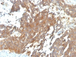 GnRHR Antibody (GNRHR/768), Novus Biologicals 0.2mg; Unlabeled:Antibodies,